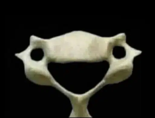 Vertebra C6