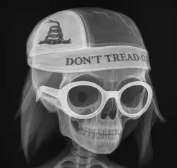XRAY
