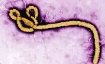 Ebola