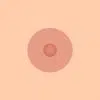 Areola